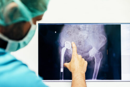 Advancements in Technology for Orthopedic Surgery